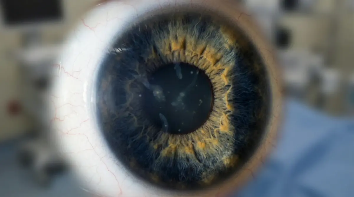 Moscas Volantes (Floaters)